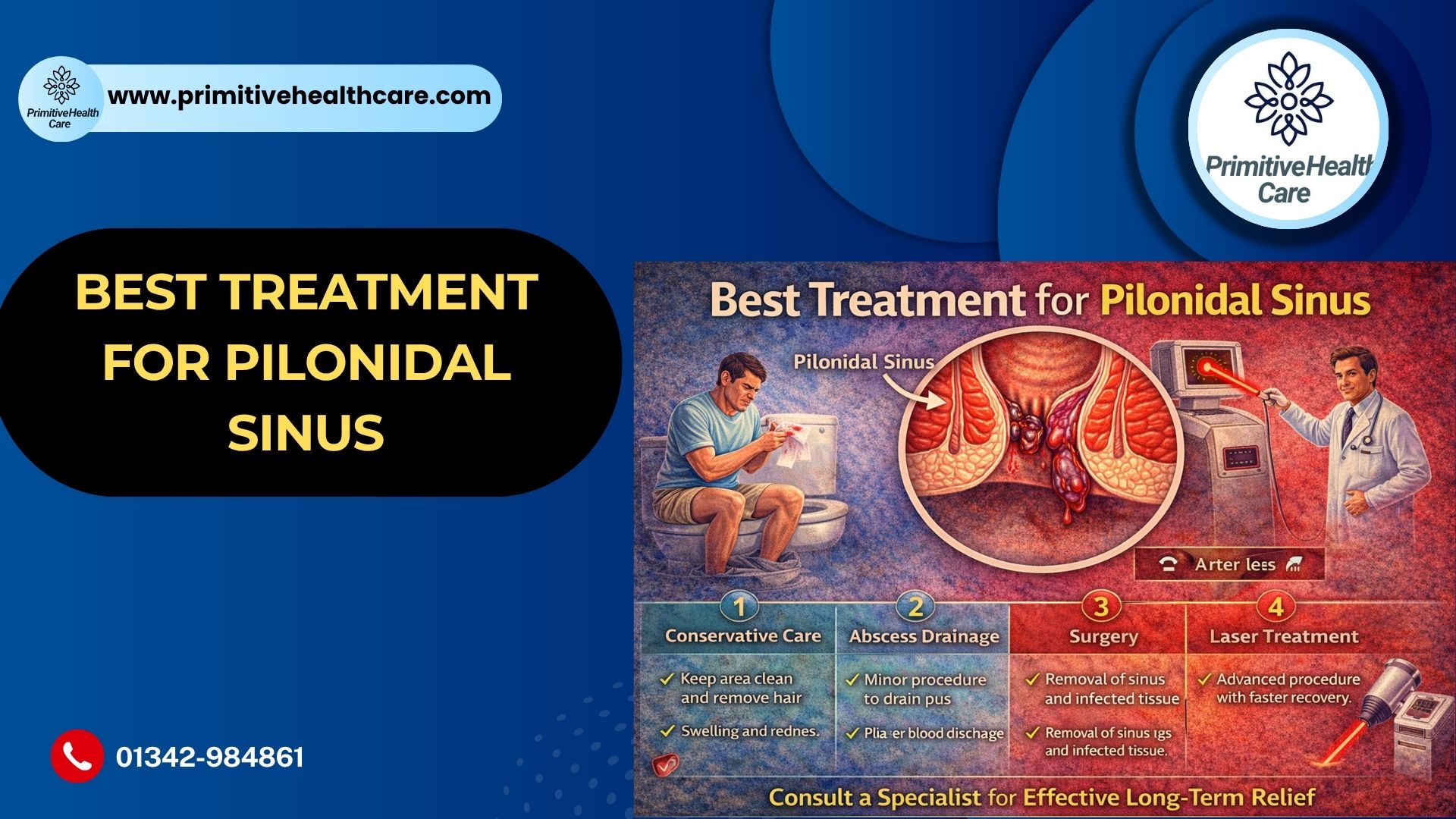 Best Treatment for Pilonidal Sinus